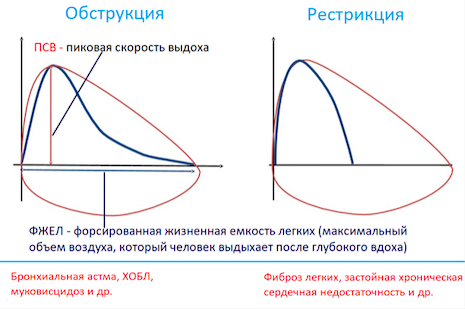Формы криво. й